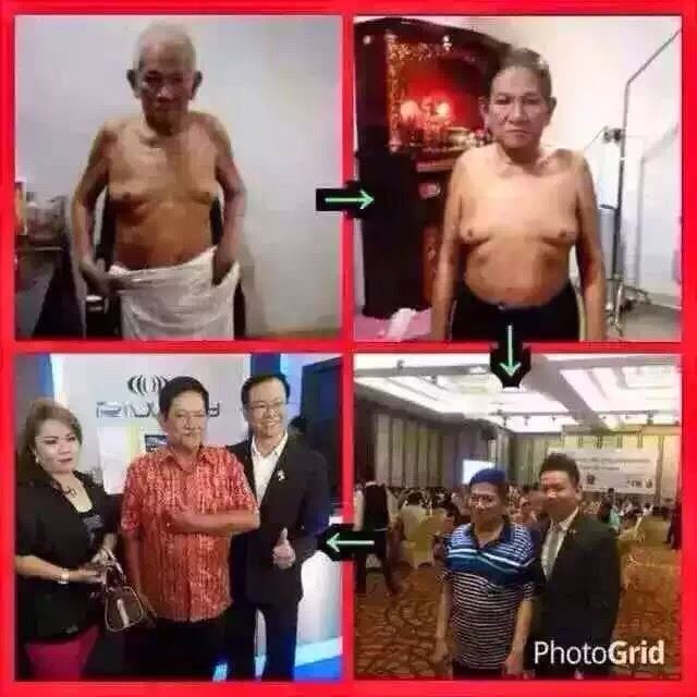 BENH-NHAN-ĐA-SU-DUNG-SAN-PHAM-PURTIER