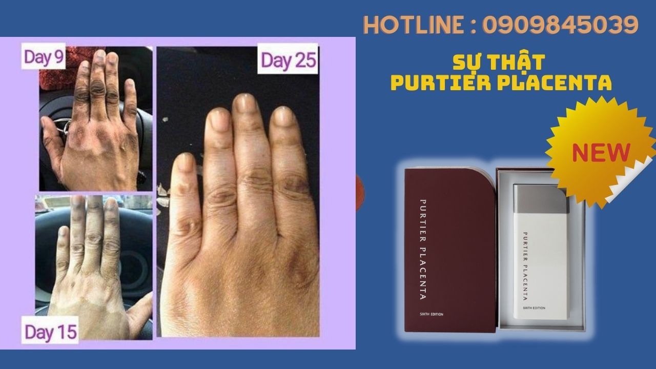 su-that-purtier-placenta-lua-dao